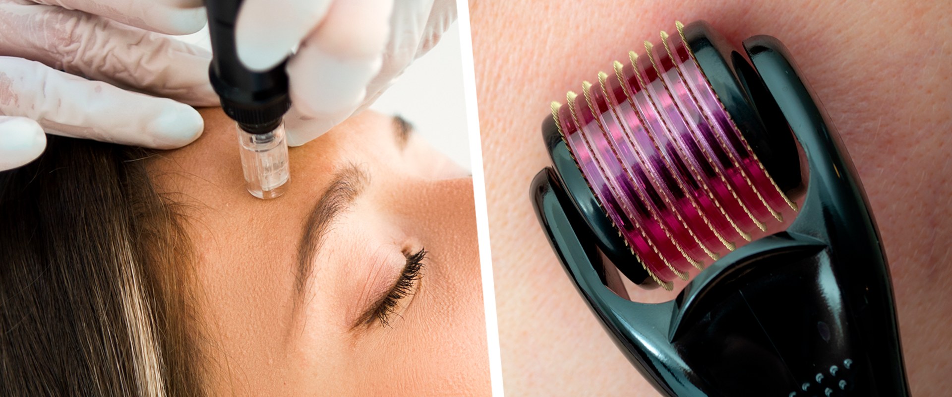 Can microneedling cause nerve damage?