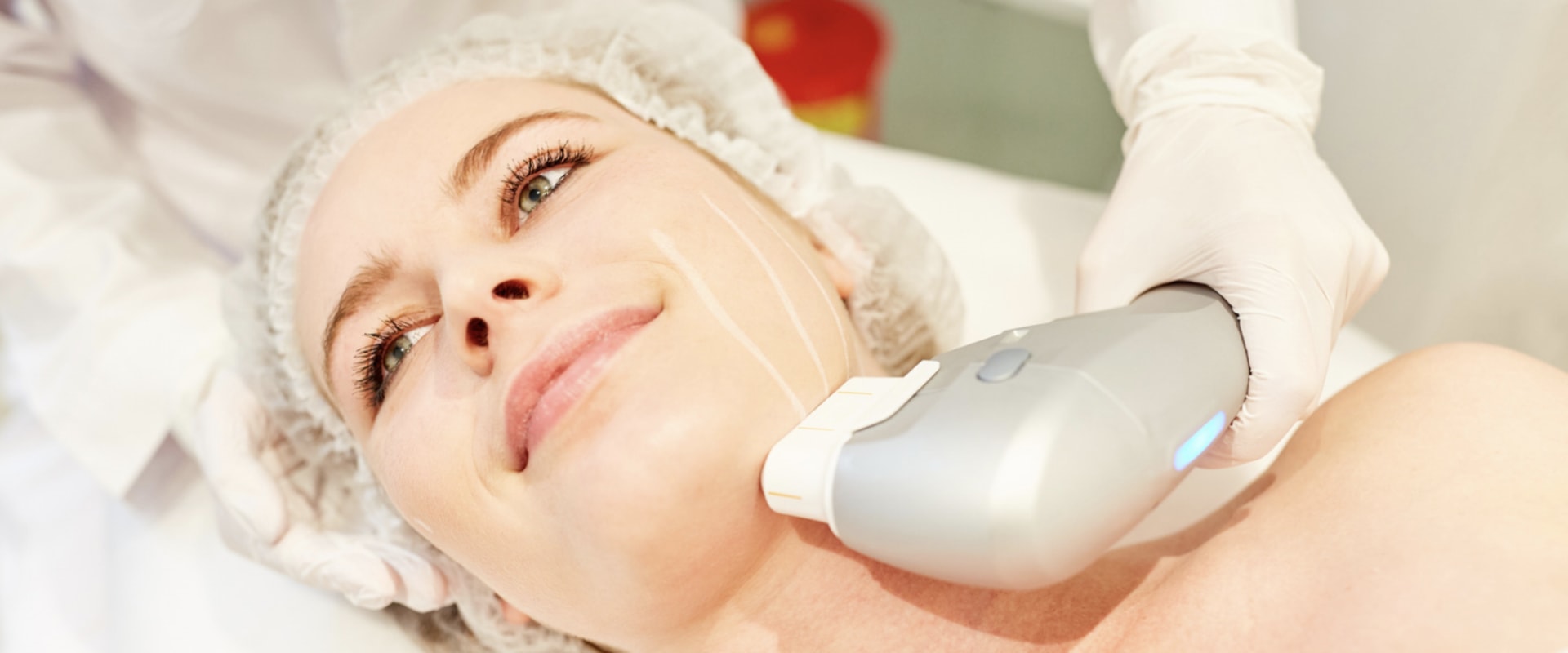Who is the Best Candidate for Morpheus8 Skin Rejuvenation Treatment?