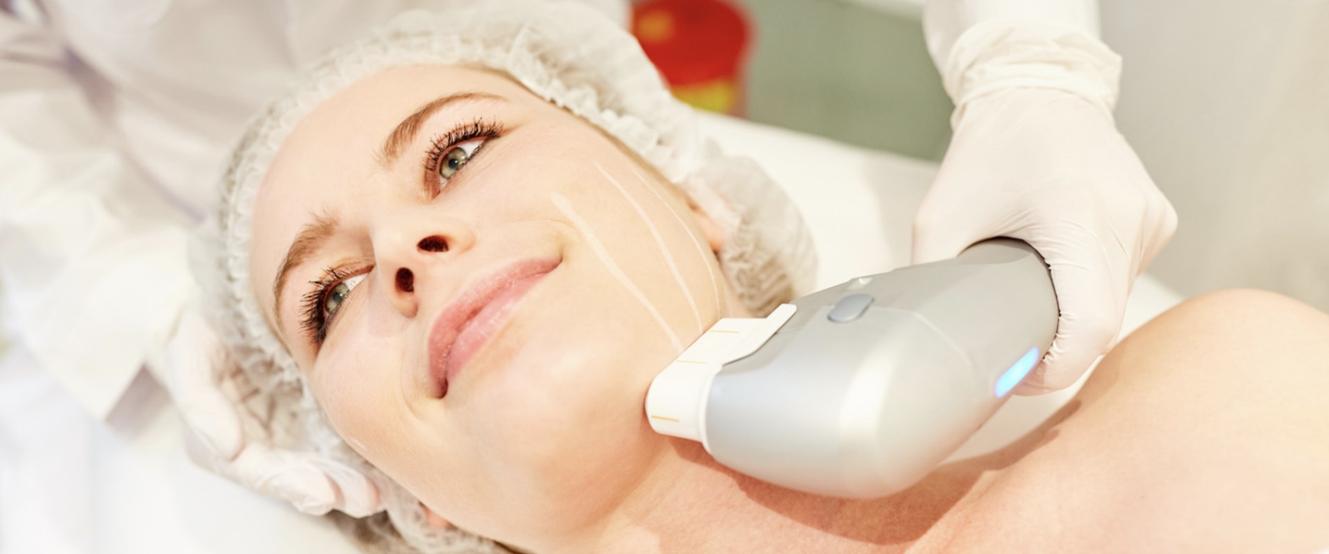 Who is the Best Candidate for Morpheus8 Skin Rejuvenation Treatment?