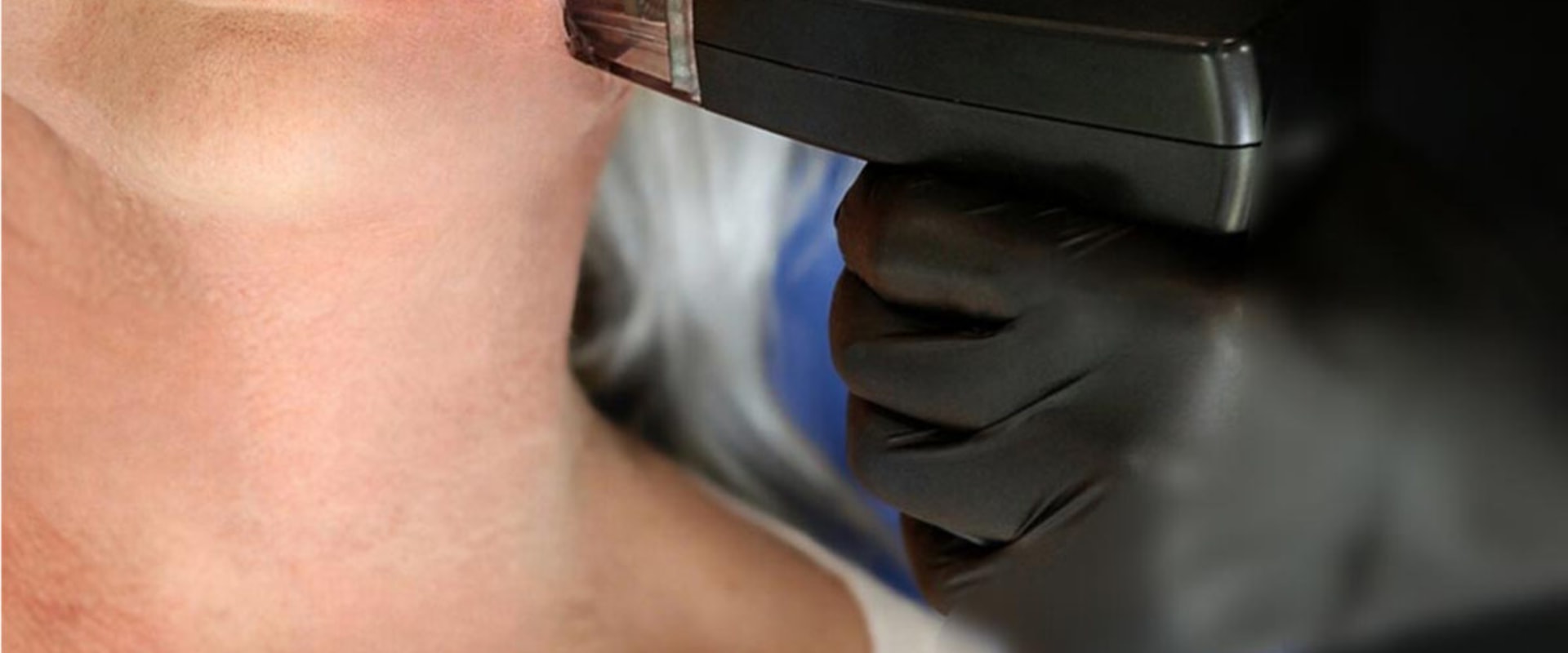 The Truth About Morpheus8 Results: What to Expect and How Long It Takes