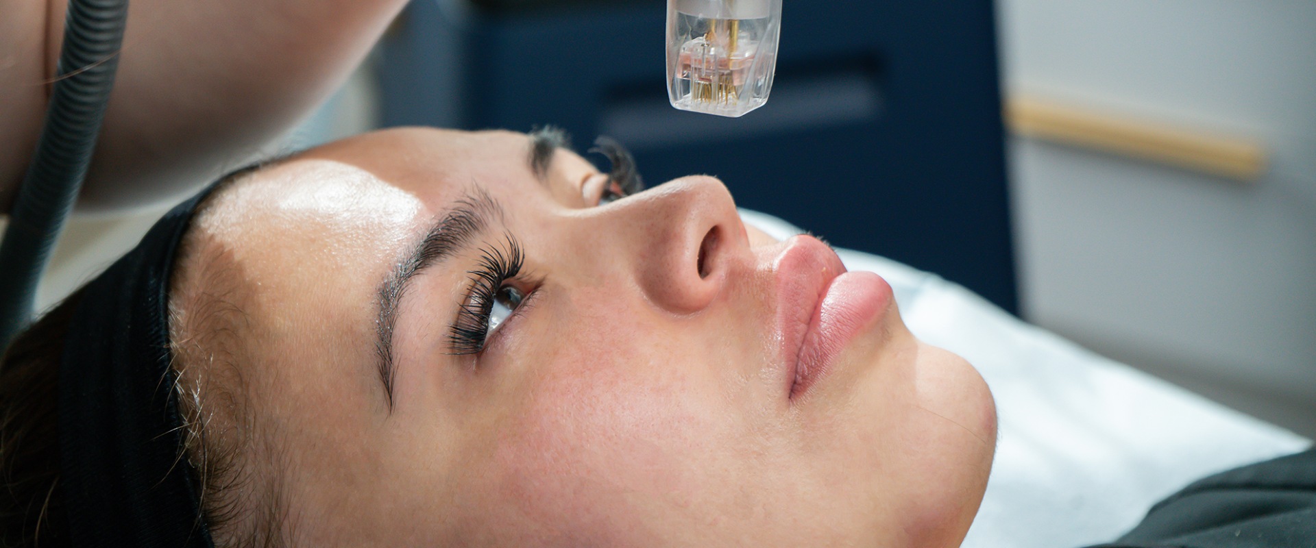 Sylfirm X: The Best Technology for RF Microneedling