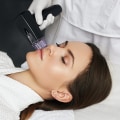 The Power of Morpheus8: Why 3 Sessions are Necessary for Optimal Results