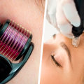 Can microneedling cause nerve damage?