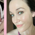 What does skin look like immediately after morpheus8?