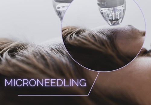 Morpheus8 vs Secret RF: Which is the Better Skin Tightening Treatment?