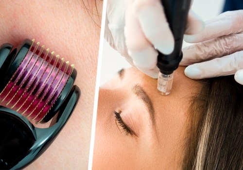 Can microneedling cause nerve damage?