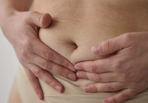 The Ultimate Guide to Morpheus8: How Long Does it Take to Melt Fat?