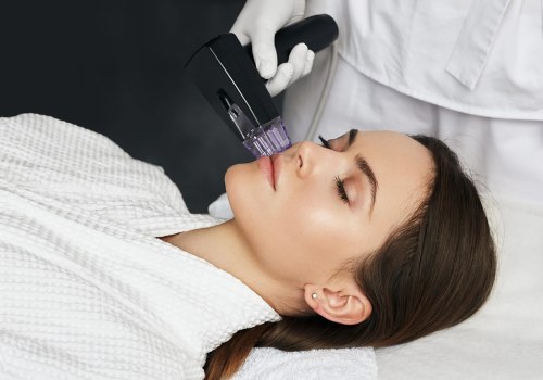 How much does one session of morpheus8 cost?