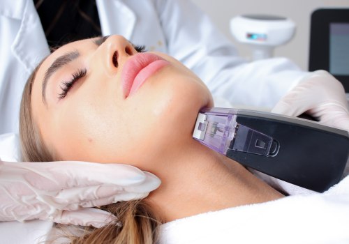 Morpheus8: The Best Microneedling Treatment for Skin Rejuvenation